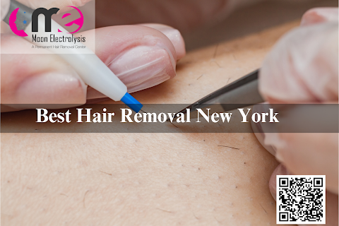 Moon Electrolysis- A permanent hair removal in NYC