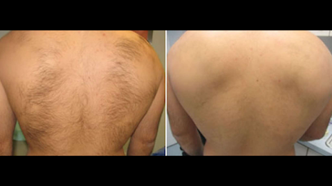 Manhattan Laser Centers