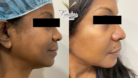 Timeless MedSpa NYC