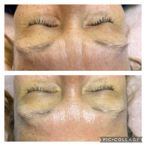 Skintastic Medi Spa - Botox in Riverside | Med Spa Riverside | Hydrafacial Riverside | Lip Fillers Riverside, California