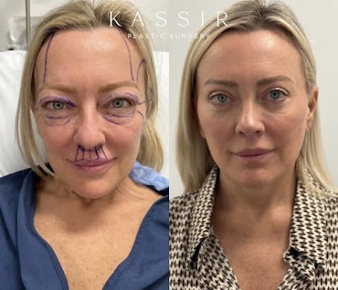 Kassir Plastic Surgery