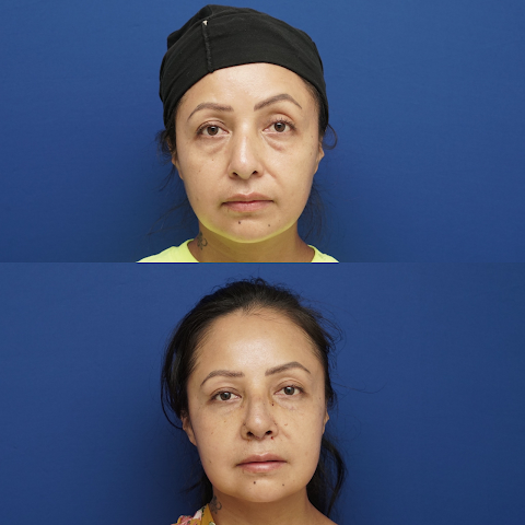 Shah Plastic Surgery, PLLC
