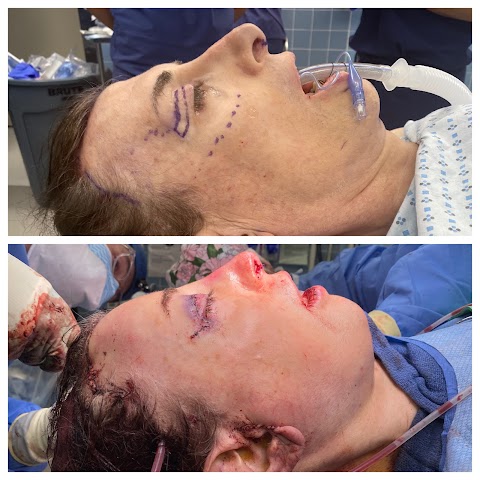 Nicholas Bastidas, MD - Plastic Surgery