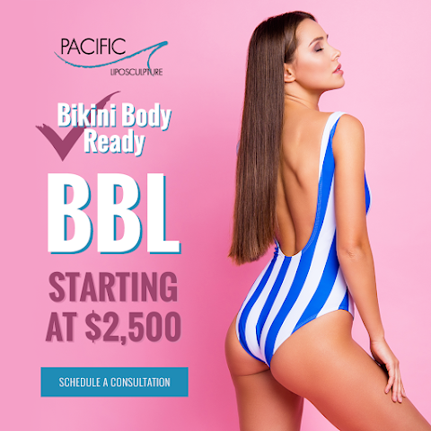 Pacific Lipo San Diego