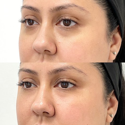 Skin Specifics