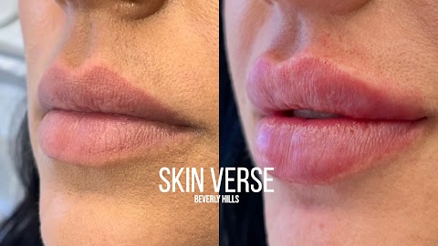 Skin Verse
