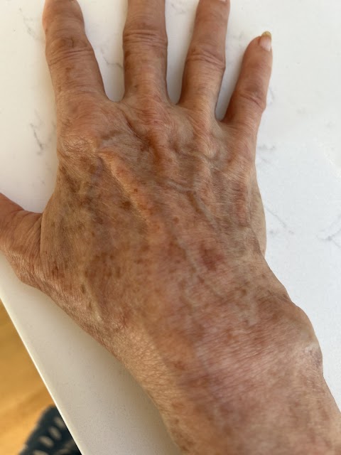Cosmetic Dermatology | Kaiser Permanente San Francisco Medical Center