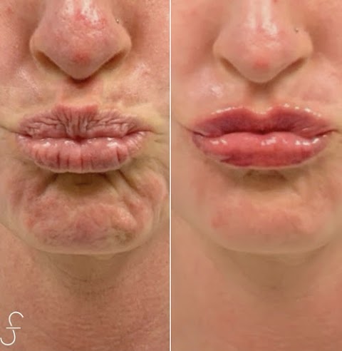 SF Bay Area Plastic Surgery - Morgan Hill