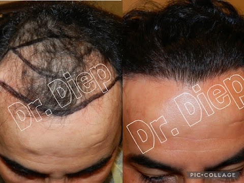 Medical Hair Transplant & Aesthetics