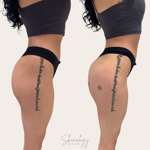 Skinology MedSpa
