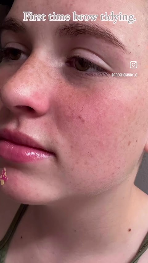 Facials By Lo