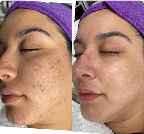 Unblemished Skin Studio