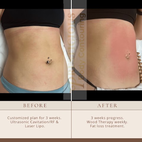 Prestigious Body Contouring Body Sculpting Services