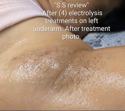 Linas Electrolysis Center
