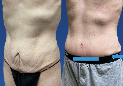 Luxe Aesthetic Surgery & Medical Spa - Hi-Definition Liposuction, Breast Augmentation, Hair Restoration &Transplant