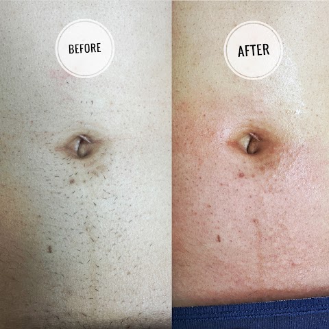 Apex Electrolysis Studio