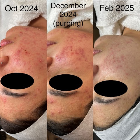 Hello Skin