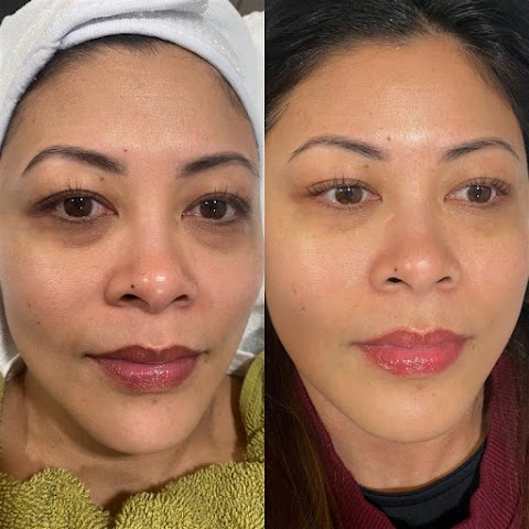 Skin VOgue