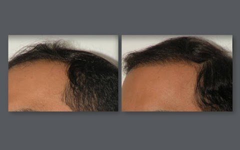 Beverly Hills Hair Group