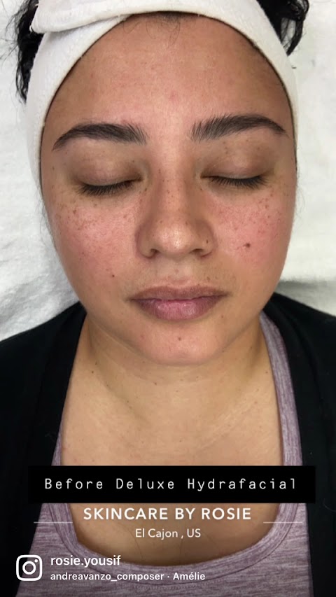 Skincare By Rosie