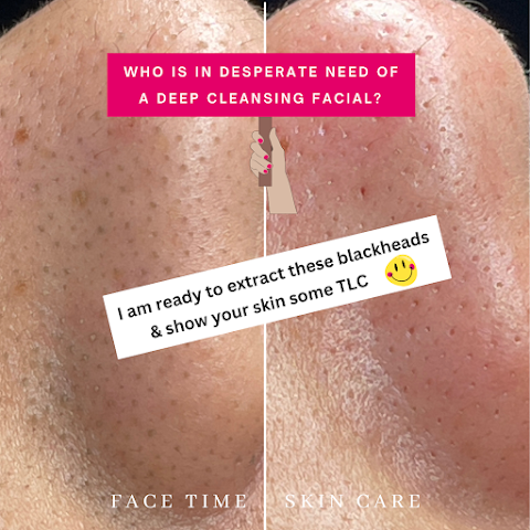 Face Time Skin Care