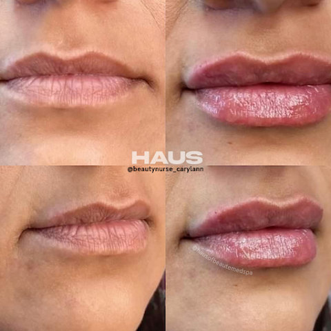 Haus of Beauté Medical Spa