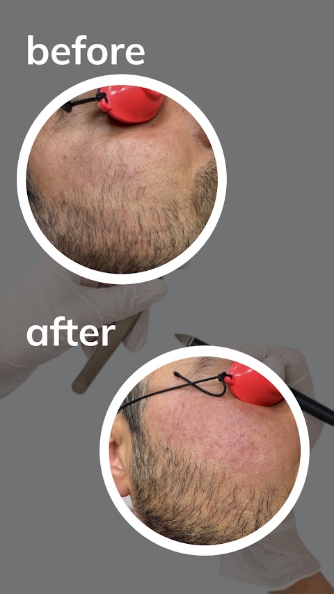 Velvet Touch Electrolysis