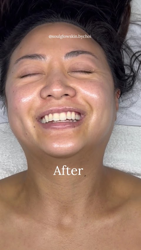 SOUL GLOW ESTHETICS