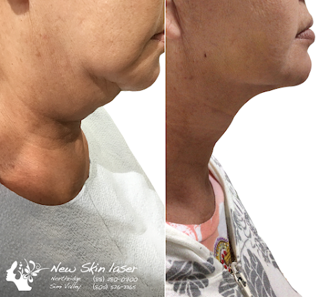 NewSkin Laser Center