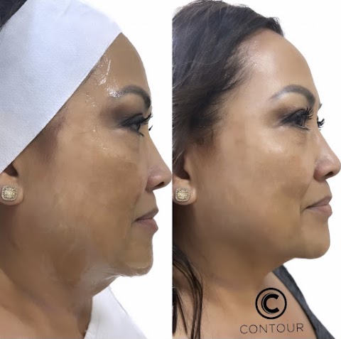 Contour Medical Spa