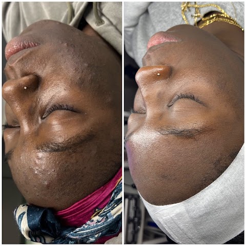 Glow Haus- Facial & Skin Care