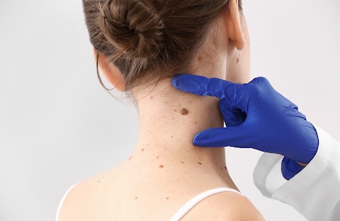 Mole Removal Temecula