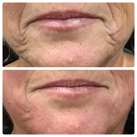 Sahar Allure Medspa