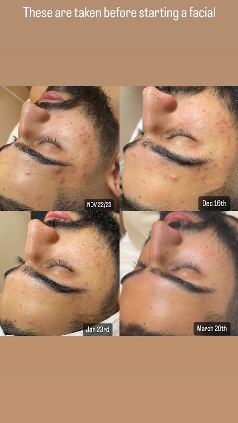 Skin care by omar