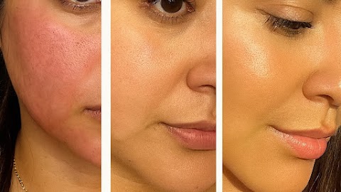 La Belle Med Spa