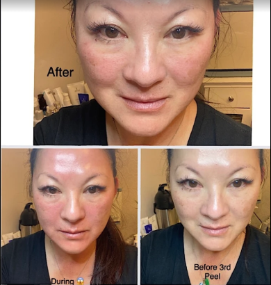 Skin by Lisa