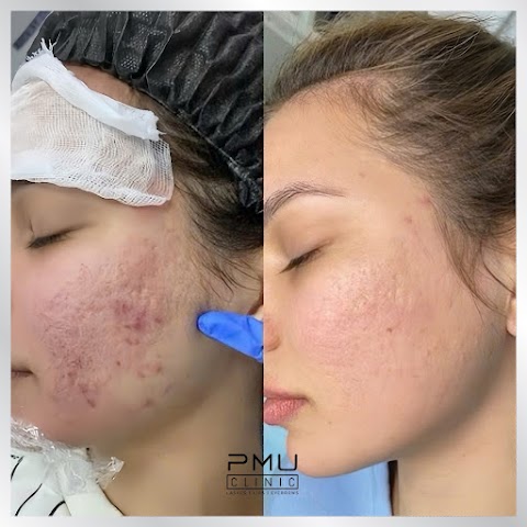 PMU CLINIC