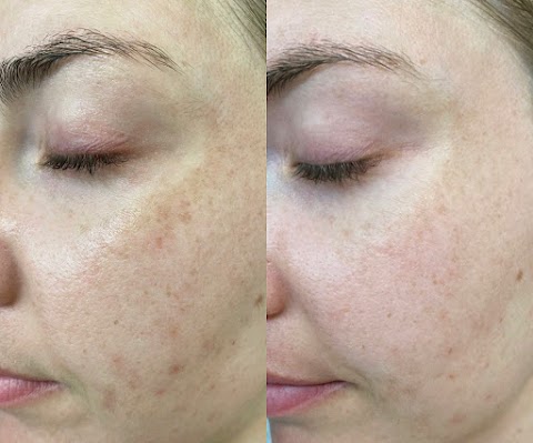 Willow And Glow Skincare