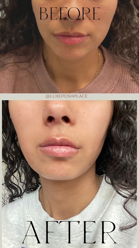 Luxe & Posh Aesthetics & Wellness