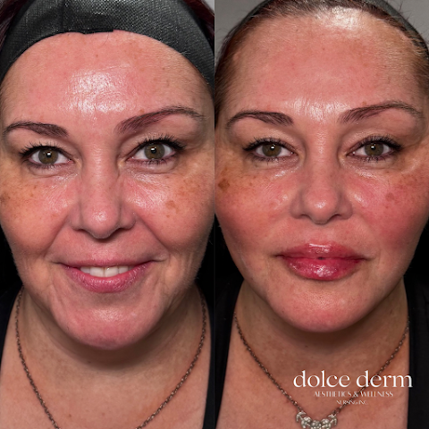 Dolce Derm Aesthetics & Wellness Nursing Inc.