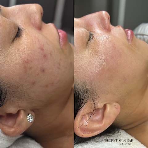 Secret Skin Bar