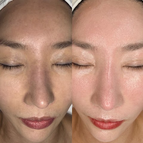 Pure Aroma Skin Care