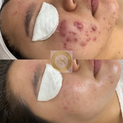 Amari Skincare and Aesthetics