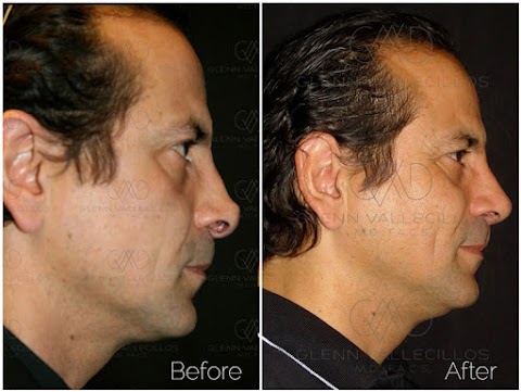 Glenn Vallecillos, MD INC