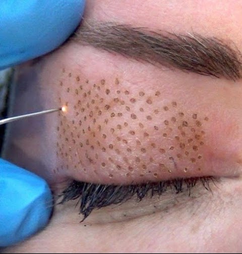 Skin Tightening Solution