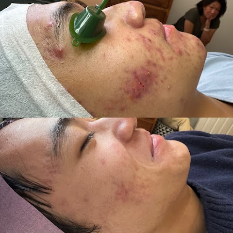 Skin Guru LA