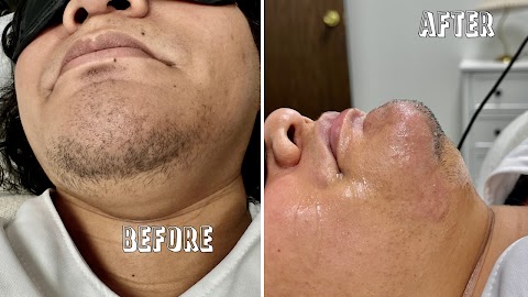 Electrolysis Hair Removal Lab