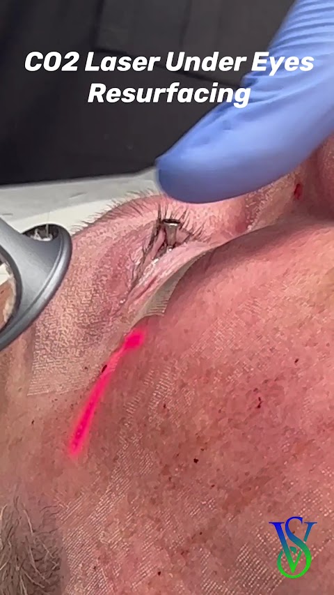 CO₂ Laser Resurfacing