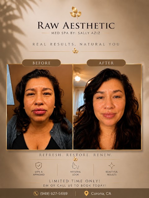 Raw Aesthetic Medical Spa by Sally Aziz