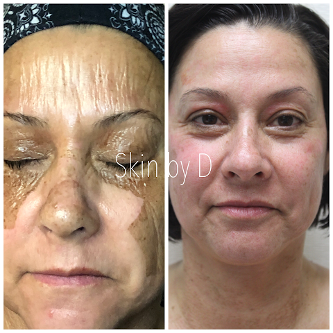Skin By D